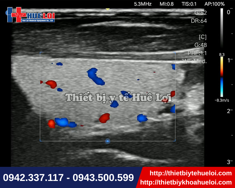 Máy siêu âm doppler màu hiện đại cho hình ảnh sắc nét