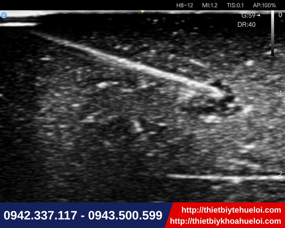 Đầu siêu âm Linear hướng dẫn kim