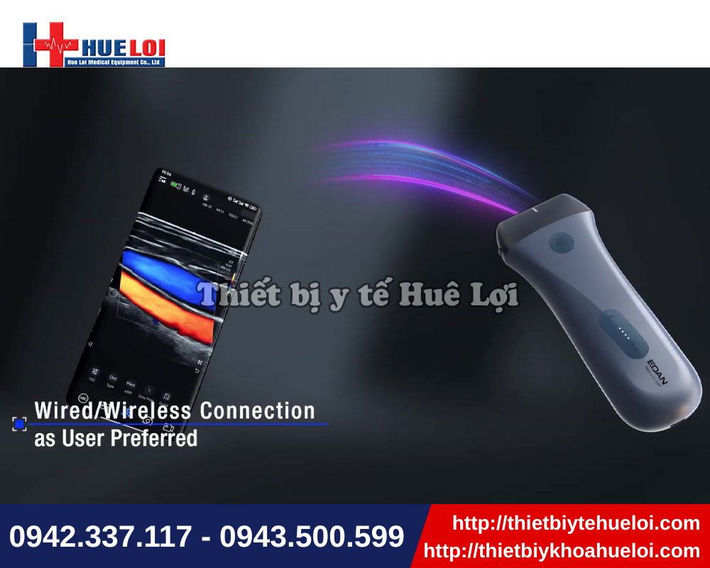 Đa dạng phương thức kết nối với máy siêu âm di động EDAN