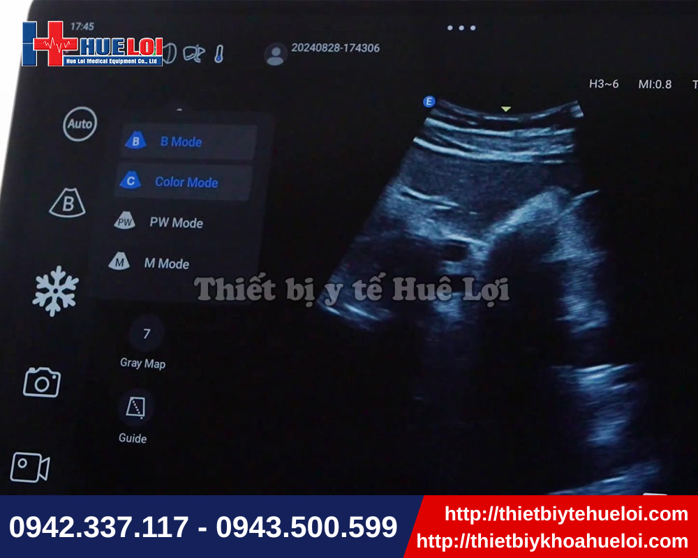 Máy siêu âm cầm tay hiện đại đa chức năng