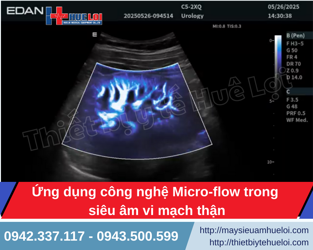 Hệ thống siêu âm tổng quát tích hợp công nghệ siêu âm vi mạch Micro Flow