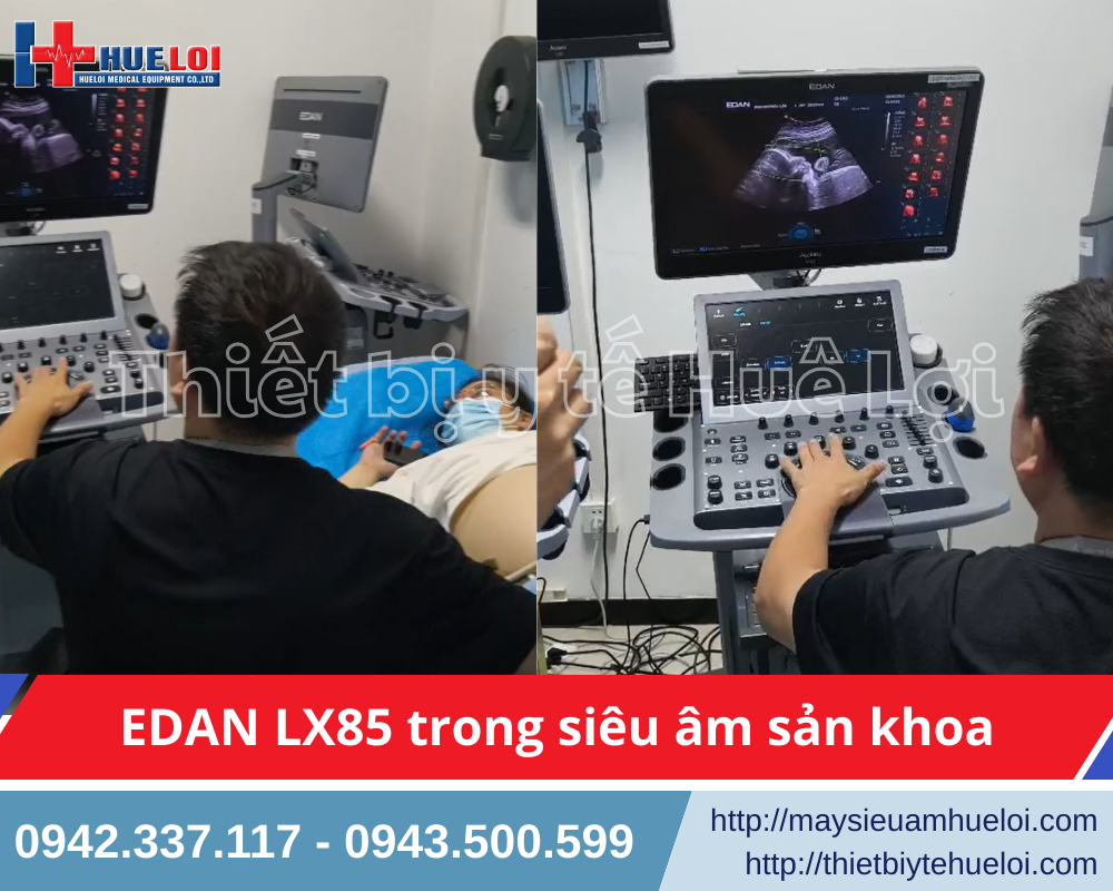 Trải nghiệm thực tế máy siêu âm 5D trong siêu âm sản khoa