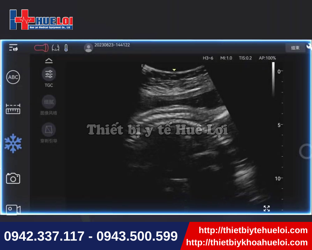 Siêu âm đa chuyên khoa với máy siêu âm cầm tay