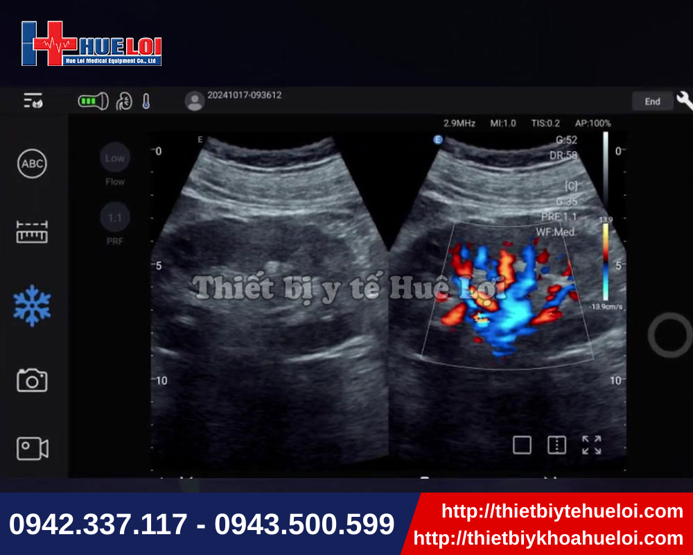 Giải pháp siêu âm linh hoạt với hình ảnh hiển thị sắc nét