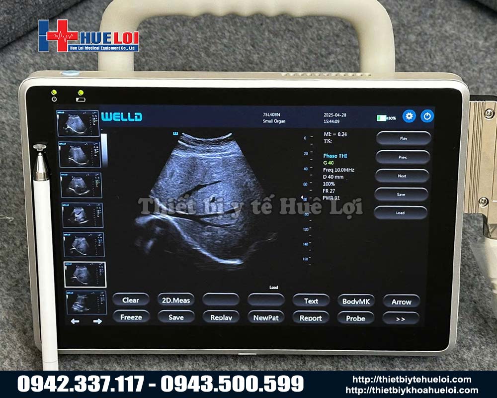Máy siêu âm hình ảnh cầm tay p10 giá rẻ