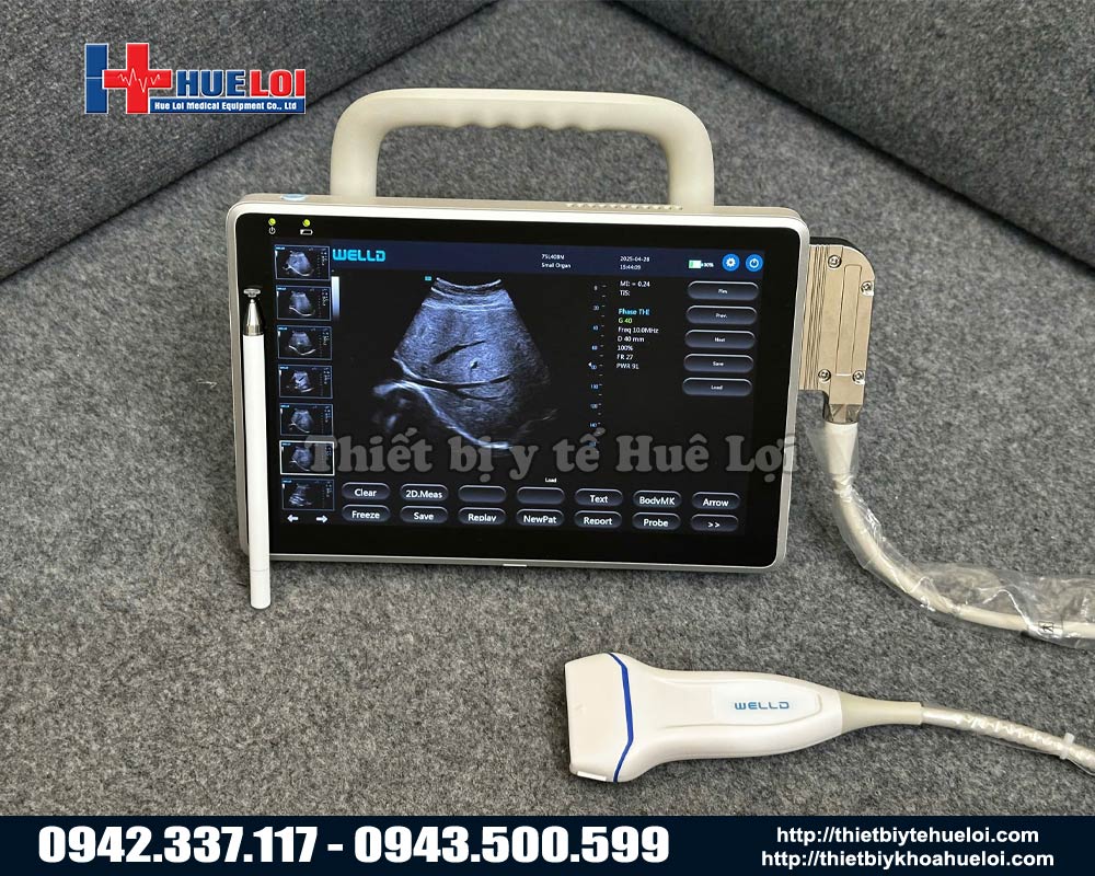 Máy siêu âm hai đầu dò xách tay giá rẻ