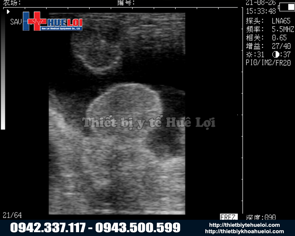 M&aacute;y si&ecirc;u &acirc;m heo cho trang trại với h&igrave;nh ảnh si&ecirc;u &acirc;m chi tiết