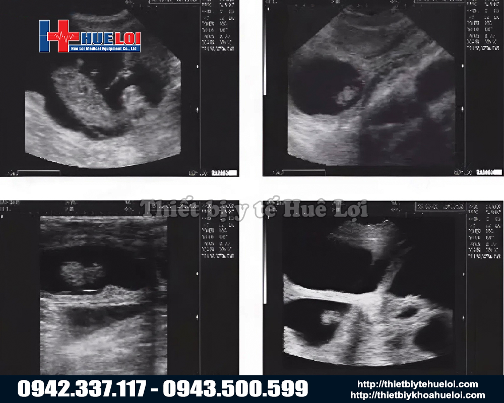 H&igrave;nh ảnh sắc n&eacute;t với m&aacute;y si&ecirc;u &acirc;m th&uacute; y chuy&ecirc;n dụng