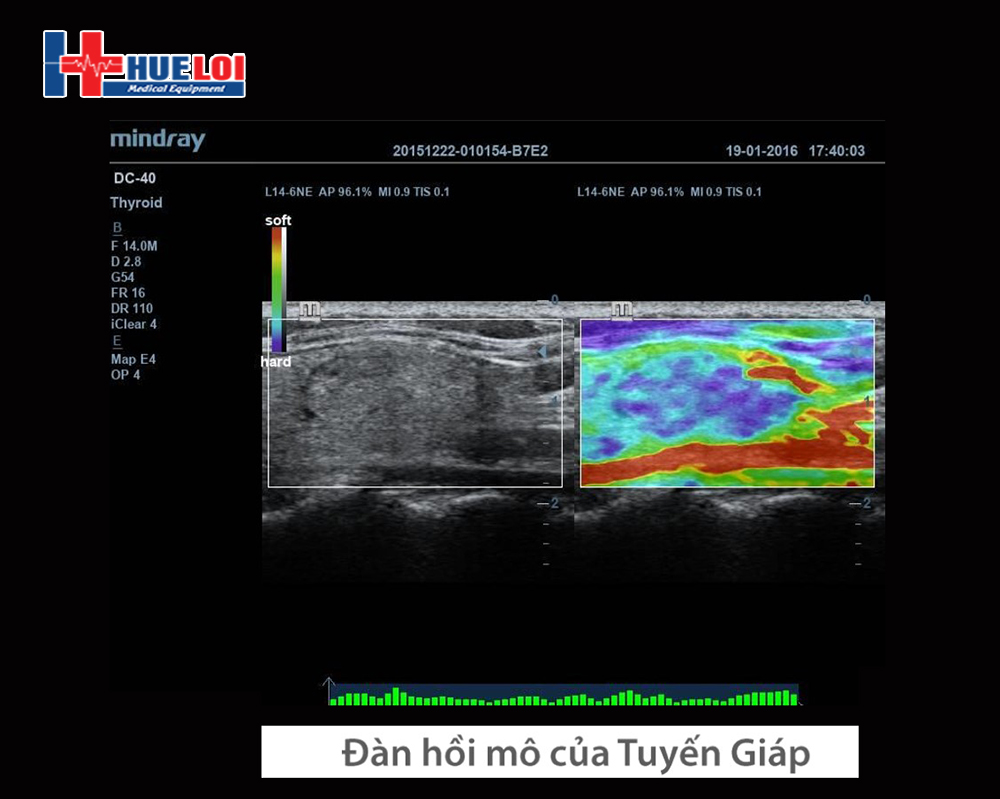 Natural Touch Elastography