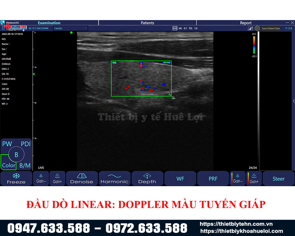 doppler-mau-tuyen-giap