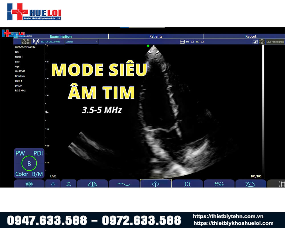 sieu-am-tim