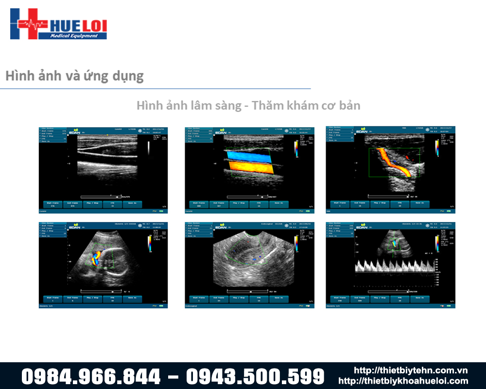 hinh-anh-tham-kham-co-ban-edan-u60